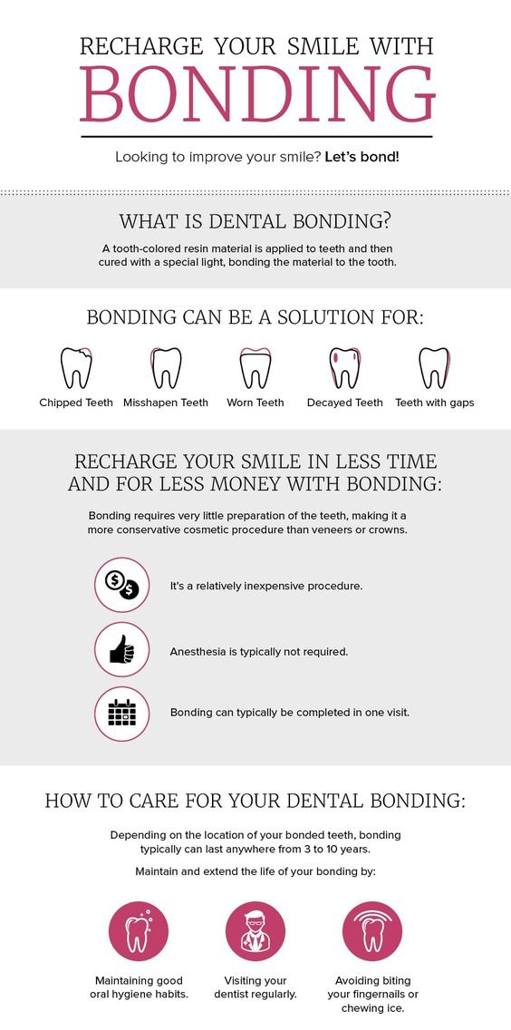 dental bonding info
