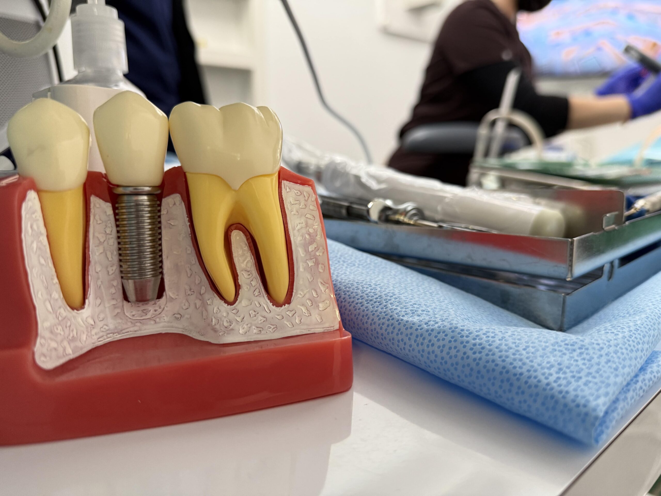 Implant